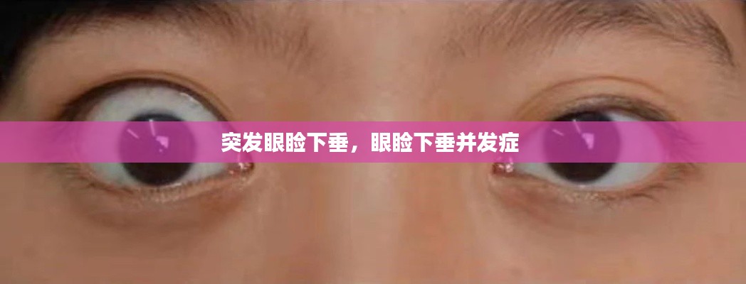 打马虎眼